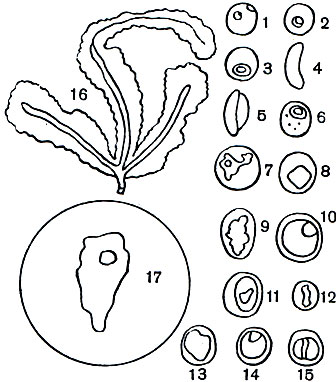 Таблица 4. Разные стадии жизненного цикла возбудителей человеческой малярии в эритроцитах крови человека (1-15) и в слюнных железах комара-переносчика Anopheles (16, 17) с препаратов, окрашенных по Гимза-Романовскому: 1-5 - возбудитель тропической малярии Plasmodium falciparum: 1-начало роста шизонта в эритроците, в одном эритроците два мелких 'кольца', в каждом из них по одному окрашенному в красный цвет ядру; 2, 3-более крупные 'кольца', одно (2) с двумя, другое (3) с одним ядром; 4-бобовидная макрогамета; 5-микрогаметоцит; 6-11 - возбудитель трехдневной малярии P. Vivax; 6-молодой шизонт в начале роста в форме кольца; 7-более крупный одноядерный шизонт амебоидной формы; 8-растущий шизонт с четырьмя ядрами; 9-выросший шизонт, распадающийся на одноядерные мерозоиты; 10-макрогамета; 11-микрогаметоцит; 12 -15 - возбудитель четырехдневной малярии P. malariae: 12-растущий шизонт в форме пояска; 13-выросший шизонт, распадающийся на одноядерные мерозоиты; 14-макрогамета; 15-микрогаметоцит; 16- продольный разрез через слюнную железу комара Anopheles maculipennis; в клетках железы, обладающих крупными ядрами, расположены многочисленные веретеновндные спорозоиты, часть их вышла в проток железы. 17-мазок слюнной железы комара Anopheles superpictus, зараженного малярийным плазмодием; в центре крупная клетка железы с ядром, вокруг нее многочисленные веретеновндные одноядерные спорозоиты